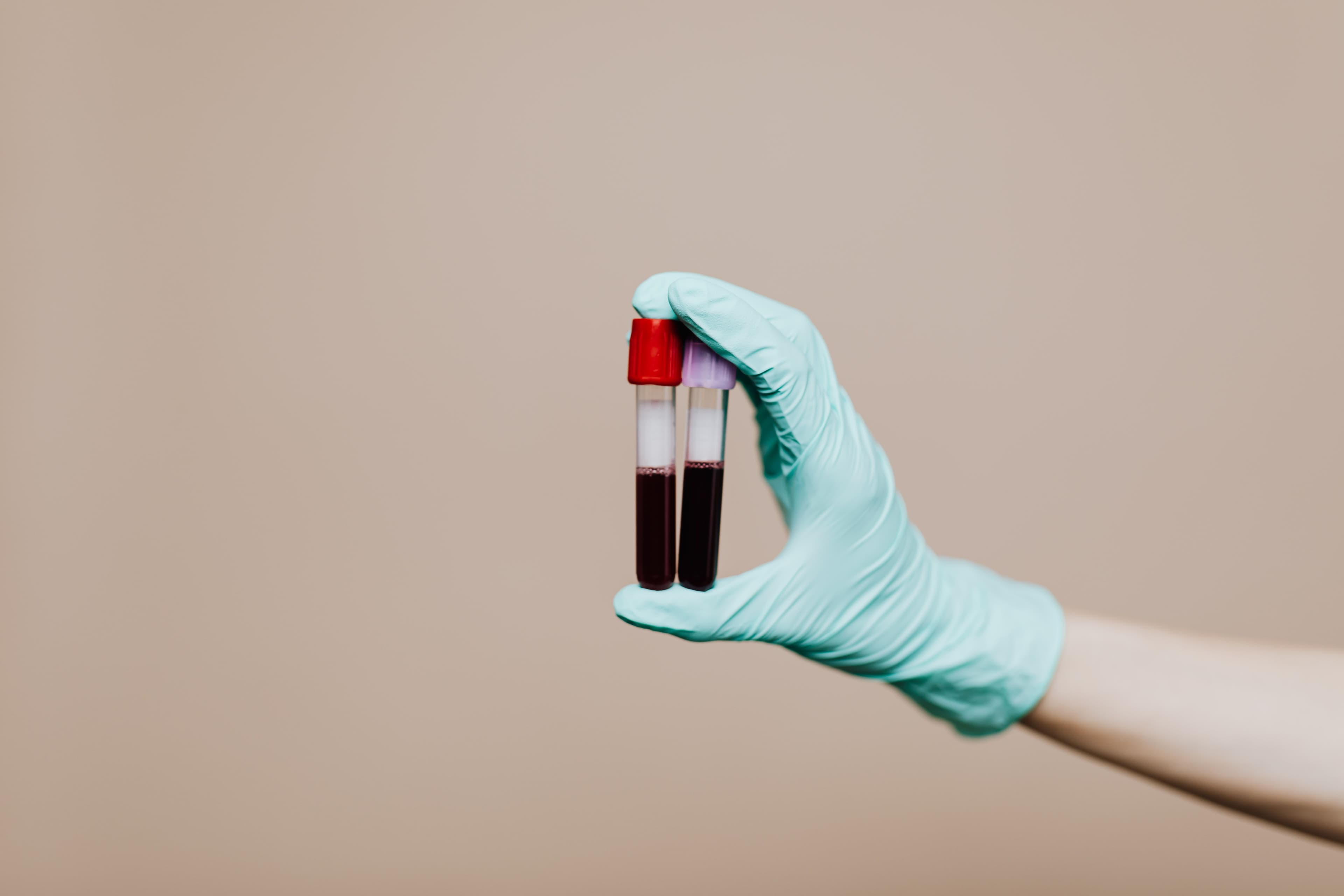 Sterile and hygienic sample handling